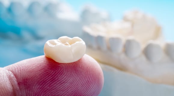 Full Porcelain Crowns