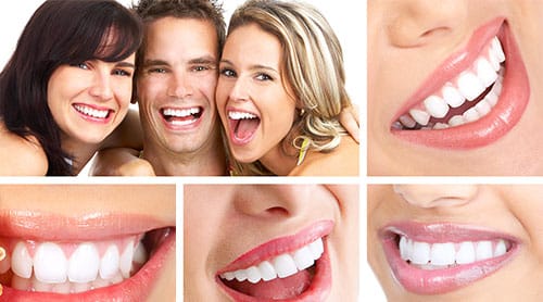 smile makeover image